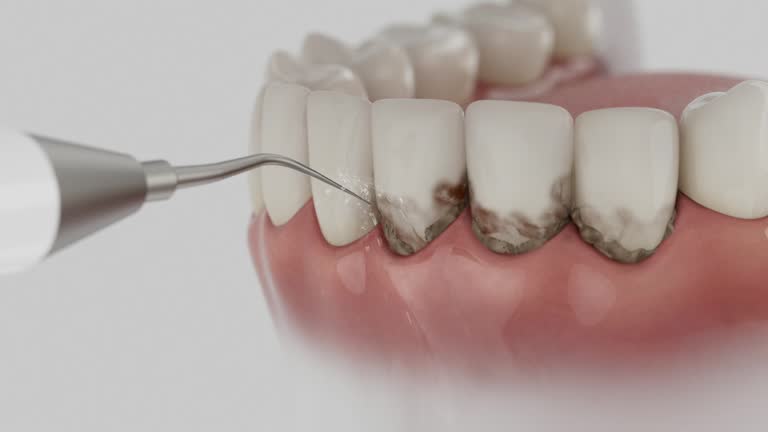Reliable Emergency Dentist contractor in Rosenberg, TX by Smile Center Dentistry